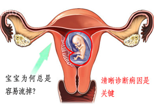 Ů�Գ���ϰ����������ô����?